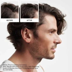 Nioxin Scalp + Hair Thickening System 2 - Trial Kit 2