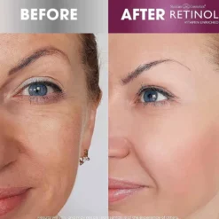 Retinol Anti-Aging Cream Cleanser 120ml